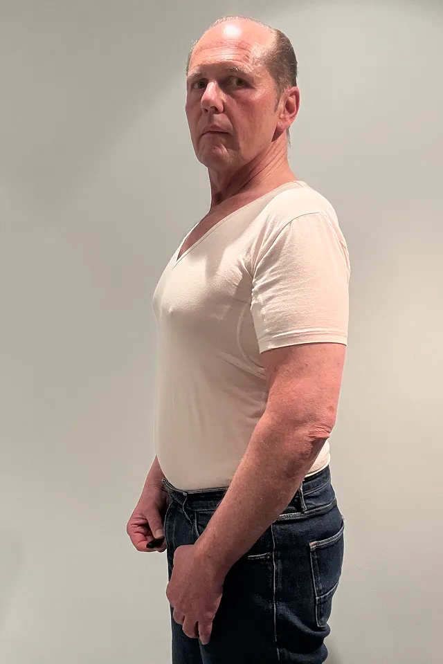 Markus après 4 mois de traitement