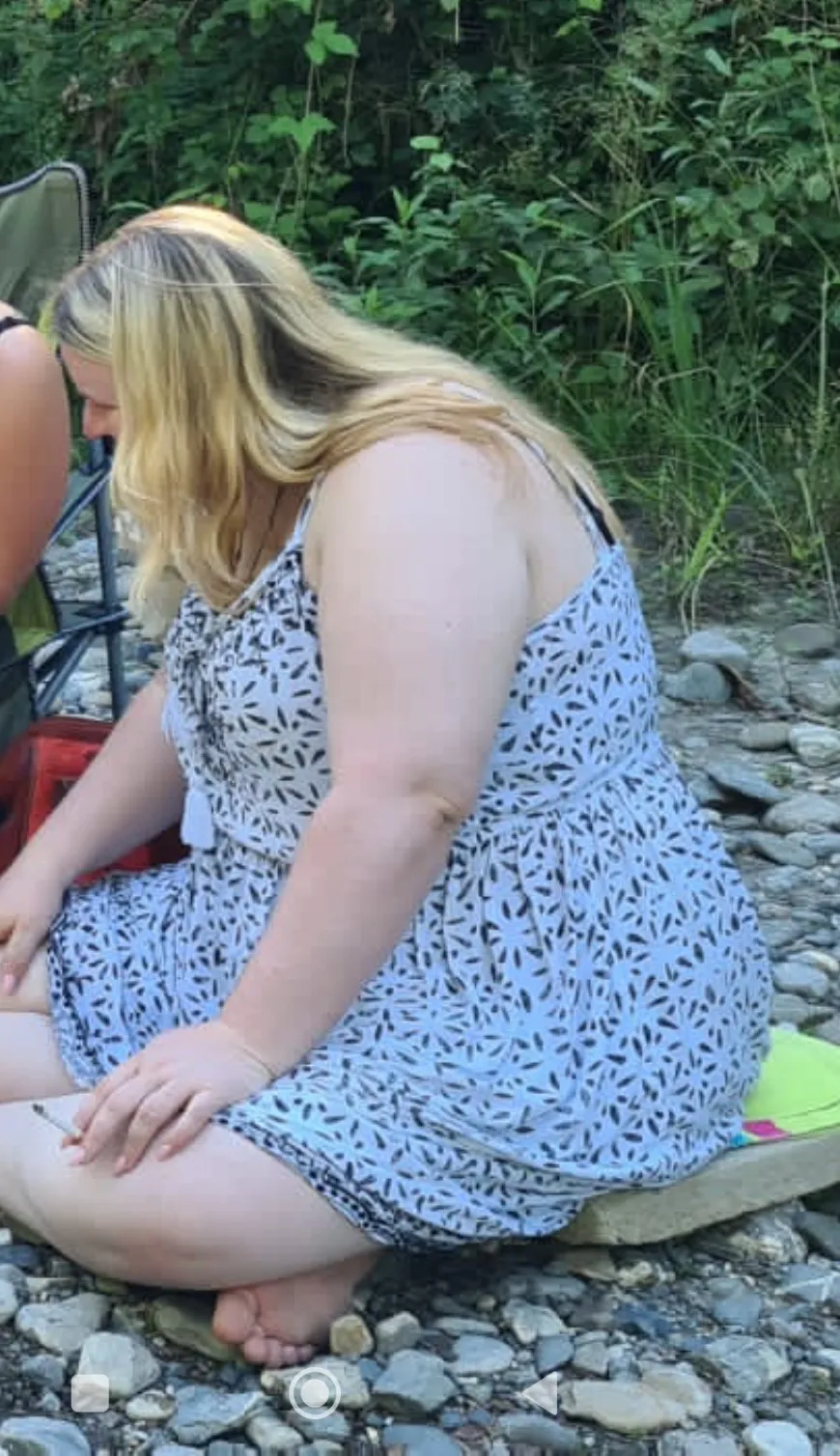 Saskia vor der Behandlung